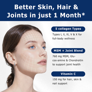 ODM OEM Polvo de Péptidos de Colágeno Múltiple con MSM, Sulfato de Condroitina y Clorhidrato de Glucosamina que Promueve la Elasticidad Natural - Product Image 5