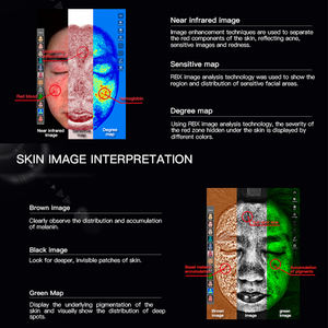 2025 новейший аппарат для анализа кожи лица AI Интеллектуальный сканер, тест типа кожи - Product Image 6