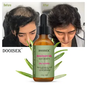 Óleo de rosemary 100% natural, óleo de rícino de hortelã e amêndoa, soro para cuidados com o couro cabeludo, óleo de crescimento e tratamento de cabelo, produto mais recente de fábrica