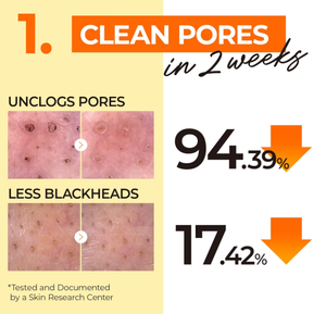 Aceite Limpiador No1 Easy Peasy, Desmaquillante Suave para Rostro y Ojos, Aceite Limpiador Hidratante con Extractos de Plantas Naturales - Product Image 3