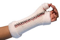 Manchon de plâtre en polymère pour rééducation orthopédique post-chirurgie – Fournitures de thérapie pour fractures