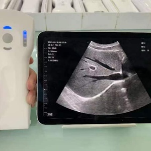 Échographe portable DCU19H 64 canaux, scanner d'échographie médicale sans fil Wi-Fi couleur - Product Image 5