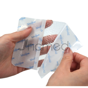 Lapisan Kontak Silikon Perekat Permeabilitas Tinggi Lapisan Kontak Luka Pembalut Jaring Silikon Medis - Product Image 4