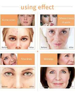 Антивозрастная Сыворотка для лица с 20% витамином С + Е, увлажняющая Гиалуроновая кислота - Product Image 5