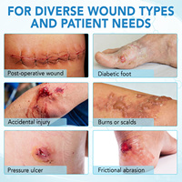 SEFUDUN 10 Pansements Efficaces pour Soins des Plaies 4'' * 4'' Pansements en Alginate de Calcium Hautement Absorbants Gaze de Pansement