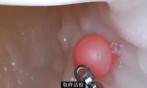 Modelo de Entrenamiento para Cirugía de Gastroscopia, Operación ERCP, Práctica de Duodenoscopia, Posición Prona (Sin Cabeza) - Product Image 6