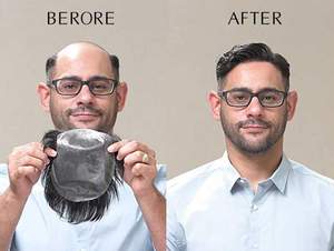 Extensiones de cabello humano de colores <span class=keywords><strong>para</strong></span> <span class=keywords><strong>hombres</strong></span> y mujeres, cinta de tupé/peluca, uso médico, pegamento <span class=keywords><strong>para</strong></span> fijar tupé, cinta de encaje frontal super - Product Image 6