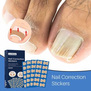 OEM ODM, Autocollant Anti-Curling pour la Correction des Ongles Incarnés, en Tissu Élastique - Product Image 2