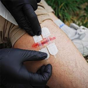 Набор для быстрого остановления кровотечения и закрытия ран без швов, 2 типа, для экстренного закрытия ран, набор для оказания первой помощи - Product Image 4