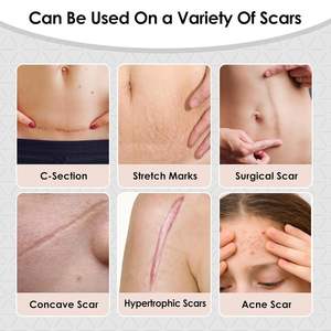 미국 표준 의료 등급 흉터 실리콘 테이프 젤 시트 주름 제거 시트 스트립 OEM ODM 흉터 테이프 바디 패치 - Product Image 4