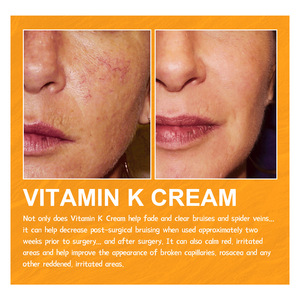 Crema de Vitamina K 60g, Crema para el Cuidado de la Piel y Tratamiento de Masaje de Piernas - Product Image 5