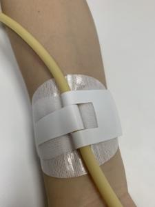 Dispositivo di fissazione del catetere del tubo uretrale della fornitura di prodotti monouso medicali - Product Image 2