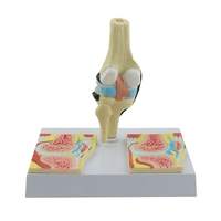 Modèle d'arthrite rhumatoïde du genou grandeur nature pour l'orthopédie humaine, vente en gros d'usine, science médicale, anatomie humaine