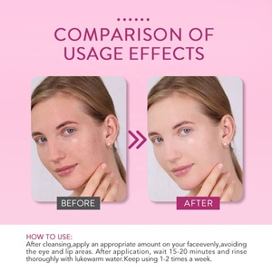 Set regalo per la rimozione dei punti neri alla curcuma Matcha con etichetta privata - Product Image 4