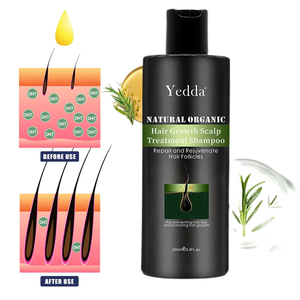 Private Label Natural Organic Anti Haarausfall Haarwuchs <span class=keywords><strong>Shampoo</strong></span> Aufklärung Des Cheveux Haarwuchs <span class=keywords><strong>Shampoo</strong></span> und Conditioner - Product Image 6