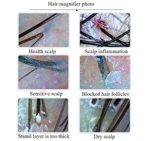 Sistema de pantalla de 10 pulgadas, máquina de análisis de cabello portátil que detecta la cámara del cuero cabelludo del salón, escáner de piel, equipo de belleza - Product Image 5