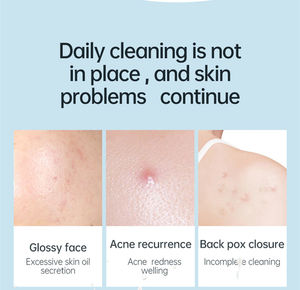 バス用品化粧品ダニ除去オイルコントロール抗ニキビホワイトニングバーオーガニック手作り美容コラーゲンロバ牛乳石鹸 - Product Image 2