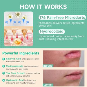 แผ่นแปะสิวไมโครดาร์ท 36 ชิ้น สำหรับ<span class=keywords><strong>รอย</strong></span><span class=keywords><strong>สิว</strong></span>ฝังลึก ผสมกรดซาลิไซลิกและมาเดคโคไซด์ - Product Image 5