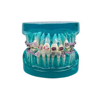 YOUYA DENTAL Nouveau Modèle Anatomique d'Orthodontie Dentaire pour l'Enseignement en Sciences Médicales, avec Supports Dentaires Standard en Résine, 2 Couleurs TM-212-A/B