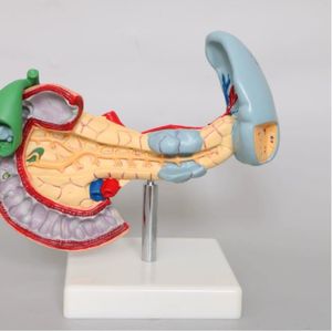 Anatomie Van Het Menselijk Lichaam Model Ziekten Van <span class=keywords><strong>Pancreas</strong></span> Milt Galblaas Anatomisch <span class=keywords><strong>Pancreas</strong></span> Model - Product Image 2