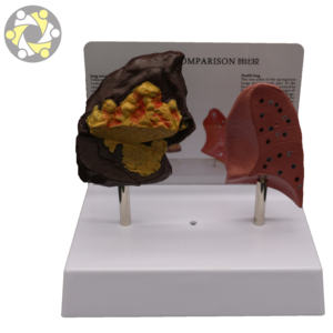 मानव फेफड़े चिकित्सा शिक्षण एनाटॉमी मॉडल - Product Image 6