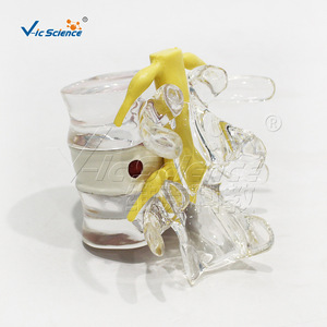 Modèle de démonstration de hernie discale lombaire, fabriqué en PVC respectueux de l'environnement, démonstration anatomique. - Product Image 2