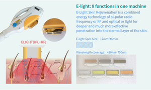 화웨이 휴대용 <span class=keywords><strong>IPL</strong></span> 전자 빛 피부 회춘 제모 <span class=keywords><strong>ipl</strong></span> 레이저 미용 기계 opt <span class=keywords><strong>ipl</strong></span> 기계 - Product Image 6