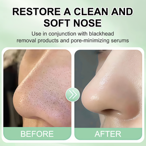 OEM/Meilleures ventes 100 pièces de masques nasaux jetables en non-tissé, hydratants et nettoyants doux, bandes démaquillantes - Product Image 4