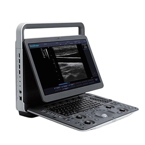 Échographe vétérinaire portable réutilisable Sonoscape E3V pour la gestion de la reproduction canine et féline - Product Image 1
