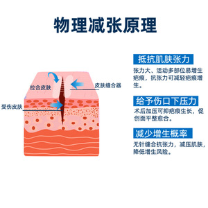 Medical Wound Tension Reducer Steri Strips 5-Piece White PP Material For Scar Healing And Sutureless Closure - Product Image 5