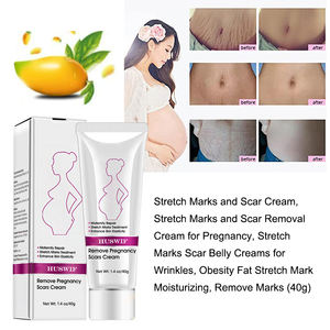 Meilleure qualité sûre effet 7 jours pour les femmes enceintes crème pour l'élimination des vergetures étiquette privée - Product Image 5