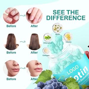 बायोटिन सॉफ्टजेल कैप्सूल बाल समर्थन पूरक बायोटिन कैप्सूल गोंद बालों के नाखून और त्वचा के पूरक कोलेजन शाकाहारी बायोटिन - Product Image 2