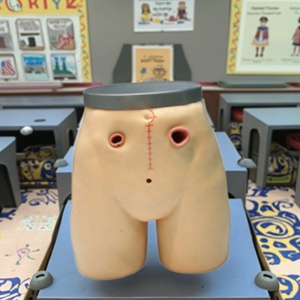 Điều Dưỡng trường cung cấp nâng cao fistulostomy chăm sóc mô hình y tế mô phỏng cho đào tạo điều dưỡng mô hình fistulostomy mô hình - Product Image 5
