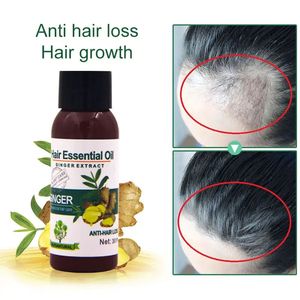Aceite Capilar de Jengibre Mokeru 30ml, Promueve el Crecimiento del Cabello y Previene la Caída, Fórmula Concentrada de Materiales Naturales para Cabello <span class=keywords><strong>Grueso</strong></span>, para Mujeres y Hombres - Product Image 5