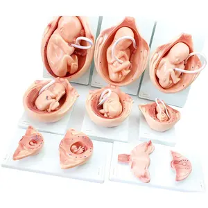 चिकित्सा भ्रूण शरीर रचना विज्ञान सिलिकॉन मोल्ड भ्रूण गठन विकास प्रक्रिया मॉडल