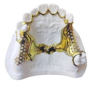 Métal de haute précision <span class=keywords><strong>DMLS</strong></span> 160*160*100mm dentier imprimante <span class=keywords><strong>3D</strong></span> SLM double Laser pour supports dentaires - Product Image 6