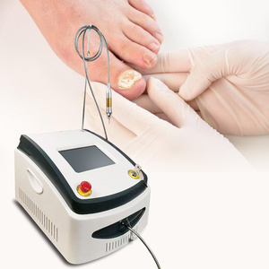 Láser de diodo de alta potencia 980nm Dispositivo de terapia de <span class=keywords><strong>hongos</strong></span> <span class=keywords><strong>en</strong></span> las uñas Eliminación de onicomicosis y verrugas <span class=keywords><strong>en</strong></span> <span class=keywords><strong>los</strong></span> <span class=keywords><strong>pies</strong></span> - Product Image 2