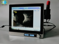 Scanner à ultrasons ophtalmique NV-6000AB Scanner A/B optique Équipement de test de numérisation AB Dispositif d'ophtalmologie Scanner oculaire biométrique