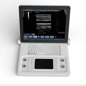 新しいポータブル15インチディスプレイユニークなタッチパッド超音波B51医療用ラップトップ超音波マシンスキャナー付き