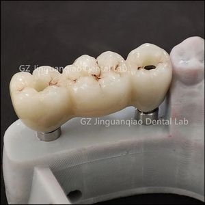 Puente de Zirconia para dentaduras postizas de implante adecuado para la mayoría de los postes de escaneo del sistema de implante se pueden proporcionar <span class=keywords><strong>Freey</strong></span> - Product Image 2