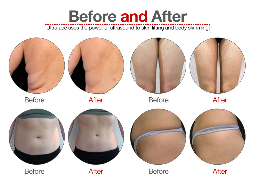 13 Tesla High Frequency Ems Slimming Device Ce Approved