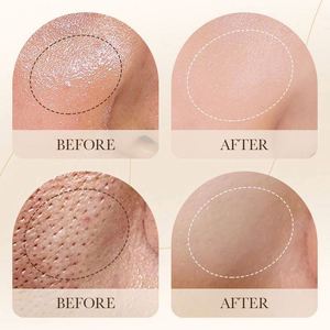 Mousse Nettoyante Bio Anti-Acné Hydratante Soin Peau <span class=keywords><strong>Arbre</strong></span> à Thé Aloès Vera Nettoyant Visage Moussant Brosse Nettoyante Faciale - Product Image 6