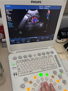 Fourniture et réparation de la machine à ultrasons portable CX50 - Product Image 5