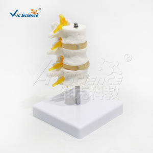 Modèle de vertèbres lombaires à trois segments de haute précision, en PVC, avec structure précise ; une démonstration de pathologie - Product Image 1