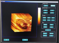Échographe Doppler numérique portable 3D 4D le moins cher de Chine / Scanner Système d'échographie diagnostique