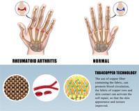 Gants d'arthrite de Compression pour hommes et femmes, demi-doigt, Support de poignet, coton, soulagement de la douleur articulaire, attelle de main, gants de bracelet de thérapie