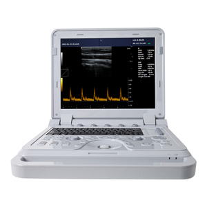 Contec Cms600p2plus Pseudo Kleur Doppler Echografie Machine <span class=keywords><strong>Ultrasone</strong></span> B <span class=keywords><strong>Ultrasone</strong></span> Doppler - Product Image 4