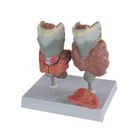 Modelo Patológico de Tiroides, Sistema Endocrino Humano, Anatomía Médica