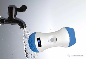 Sonostar Ultrasound 2 In 1 Dubbele Hoofd Kleur <span class=keywords><strong>Doppler</strong></span> Convex & Lineaire Ultrasound Machine Scanner - Product Image 6