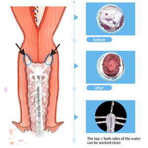 Système de nettoyage vaginal réutilisable Douper, nettoyant vaginal, lavement vaginal, douche vaginale pour femmes, capacité de 300 ml - Product Image 6